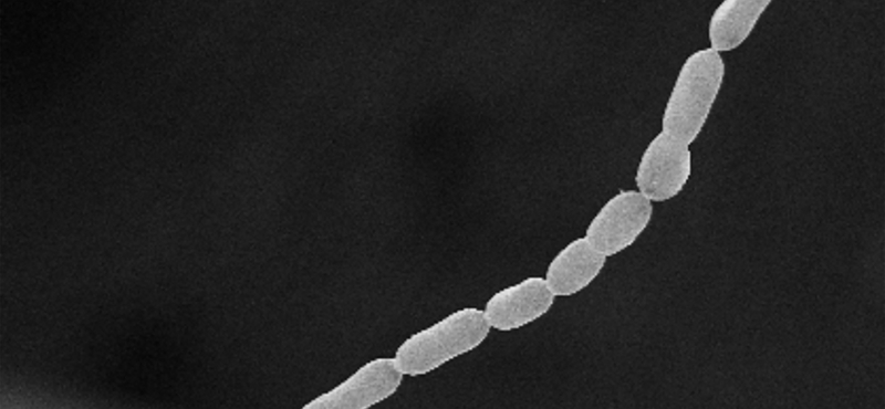 Megtalálták a világ legnagyobb baktériumát, szabad szemmel is látható