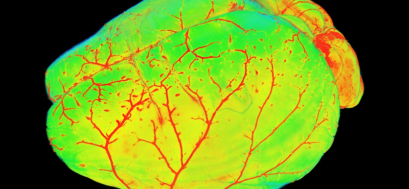 Emberi agysejteket oltottak egerekbe, ez lett az eredménye