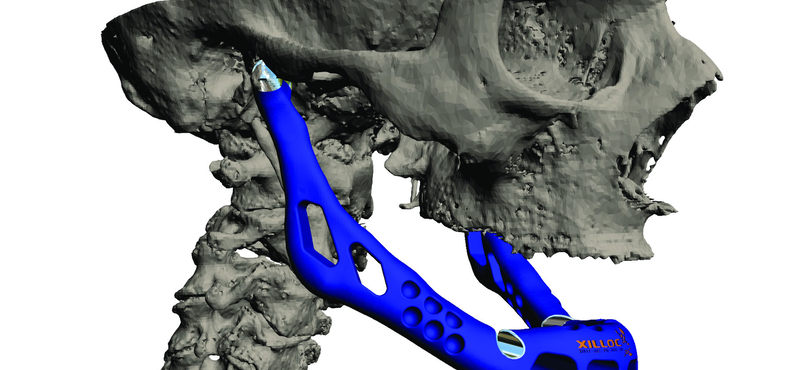 Csokitorta, ékszer és emberi szív a 3D-nyomtatóból 