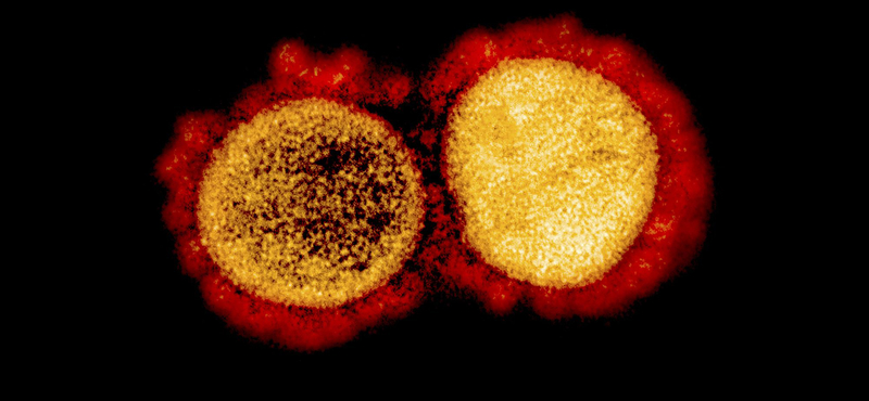 Egy úttörő kutatás miatt 90 embert fertőznek meg szándékosan a koronavírussal