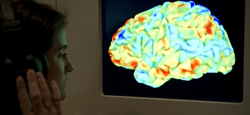 Magyar kutatók fedezték fel, hogyan érik felnőtté egy serdült agya